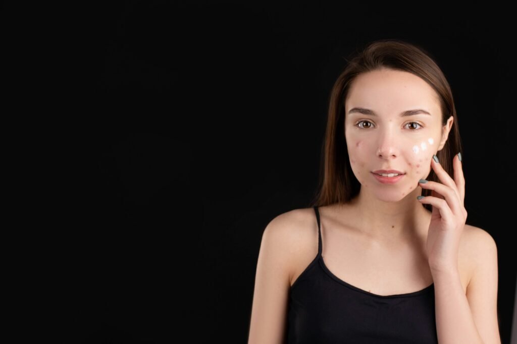 causes of hyperpigmentation